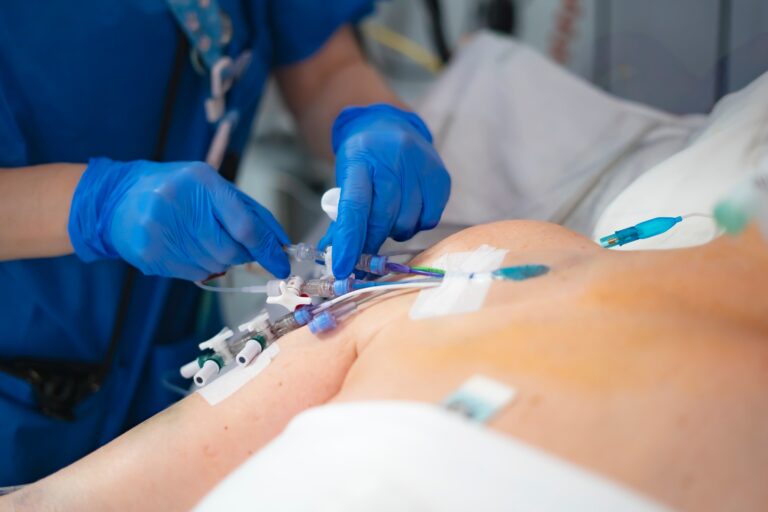 Nurse adjusting iv catheter and multiple tubes connected to patient in hospital bed